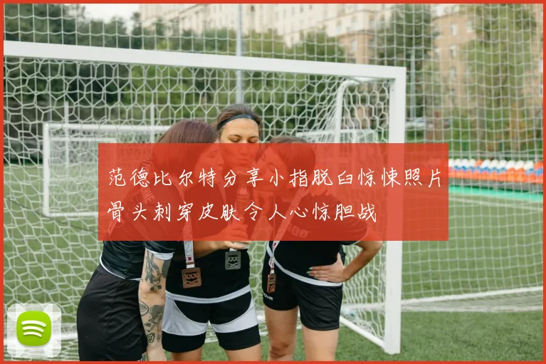 范德比尔特分享小指脱臼惊悚照片骨头刺穿皮肤令人心惊胆战